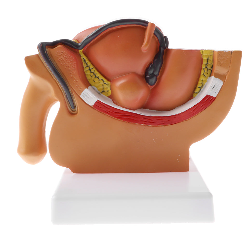Maxbell 1:2 Sagittal Section Of Human Male Pelvis Testicle Prostate Structure Model School Teaching Display Kits