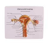 Maxbell 1:1 Human Female Uterus Ovary Pathological +Normal Model Anatomical Study