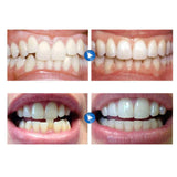 Maxbell Dental Mouth Guard for Grinding Teeth Tooth Protector Night Guard Clear