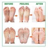 Maxbell Foot Peel Masks Moisturizing Foot Socks for Dry Heels Women Men Coconut