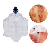 Maxbell Vacuum Cups Back Pain Relief Cupping Cans Jars Body Massage Star Shaped