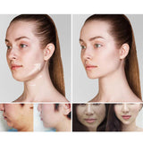 Maxbell 5x Slimming V Line lifting Mask Double Chin Reducer Tightening 5pcs with box