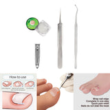 Maxbell Professional Ingrown Toenail Correction Tools Set Clippers Patch 50 Liner