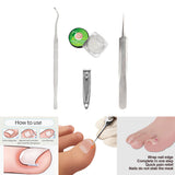 Maxbell Professional Ingrown Toenail Correction Tools Set Clippers Patch 50 Liner