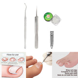 Maxbell Professional Ingrown Toenail Correction Tools Set Clippers Patch 50 Liner