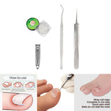 Maxbell Professional Ingrown Toenail Correction Tools Set Clippers Patch 50 Liner