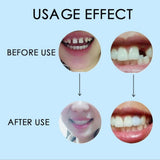 Maxbell Thermal Beads Teeth Veneer Moldable Denture Temporary Tooth Repair Tool 30ml