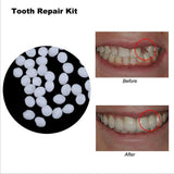 Maxbell Thermal Beads Teeth Veneer Moldable Denture Temporary Tooth Repair Tool 30ml