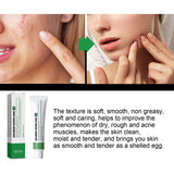 Maxbell Freckle Cream Moisturizer Repair Cream for Melasma Dark Spots Moisturizing