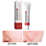 Maxbell Freckle Cream Moisturizer Repair Cream for Melasma Dark Spots Moisturizing