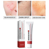 Maxbell Freckle Cream Moisturizer Repair Cream for Melasma Dark Spots Moisturizing