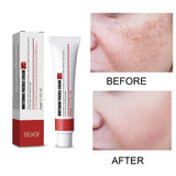 Maxbell Freckle Cream Moisturizer Repair Cream for Melasma Dark Spots Moisturizing