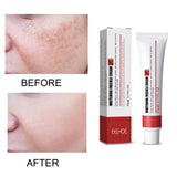 Maxbell Freckle Cream Moisturizer Repair Cream for Melasma Dark Spots Moisturizing