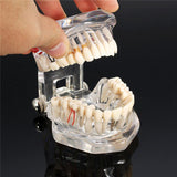 Maxbell Magnification 2x Human Mouth Dental Teeth Pathological Model Teaching Tools