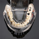 Maxbell Magnification 2x Human Mouth Dental Teeth Pathological Model Teaching Tools