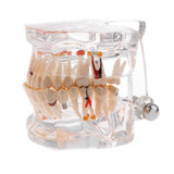 Maxbell Magnification 2x Human Mouth Dental Teeth Pathological Model Teaching Tools