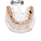 Maxbell Magnification 2x Human Mouth Dental Teeth Pathological Model Teaching Tools