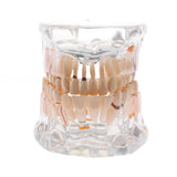 Maxbell Magnification 2x Human Mouth Dental Teeth Pathological Model Teaching Tools