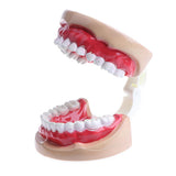 Maxbell 2X Large Children Dental Teeth Model Dentist Teaching Oral Hygiene Tool