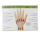 Maxbell 1:1 Advanced Human Hand Joint Muscle Wrist Joint MRI Section Medical Model