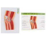 Maxbell 1:1 Advanced Human Elbow Joint Muscle Skeleton MRI Section Medical Model