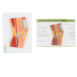 Maxbell 1:1 Advanced Human Knee Joint Muscle Skeleton MRI Section Medical Model