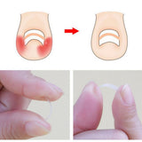 Max 100Pcs Curved Ingrown Toenail Straightening Clips Set Nail Stickers Clear