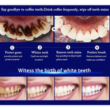 Maxbell Teeth Whitening Essence Serum Stains Remover Oral Care 10ml+10Pc Cotton Swab