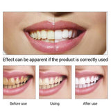 Maxbell Teeth Whitening Essence Serum Stains Remover Oral Care 10ml+10Pc Cotton Swab