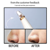 Maxbell Electric Blackhead Remover Acne Comedo Vacuum Extractor w/ 3x Suction Head