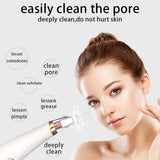 Maxbell Electric Blackhead Remover Acne Comedo Vacuum Extractor w/ 3x Suction Head