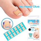 1 Set Ingrown Toenail Corrector Stickers Toe Nail Treatment Patch 72 Sheets