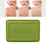 Maxbell BREYLEE 80g Soap Bar Face Body Acne Treatment Control Soap Bath Skin Care