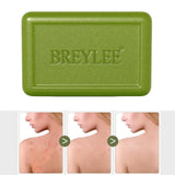 Maxbell BREYLEE 80g Soap Bar Face Body Acne Treatment Control Soap Bath Skin Care