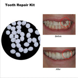 Thermal Beads Teeth Veneer Moldable Denture Temporary Tooth Repair Tool 10ml