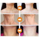Maxbell Neck Face Cream Anti Wrinkle Moisturizer Nourishing Serum for Women Men 30g