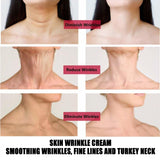 Maxbell Neck Face Cream Anti Wrinkle Moisturizer Nourishing Serum for Women Men 30g