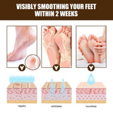 Maxbell Cracking Resistance Cream Moisturizing dry Cracking Feet Hands