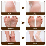 Maxbell Cracking Resistance Cream Moisturizing dry Cracking Feet Hands