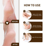 Maxbell Cracking Resistance Cream Moisturizing dry Cracking Feet Hands