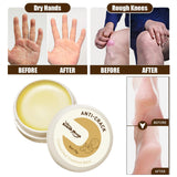 Maxbell Cracking Resistance Cream Moisturizing dry Cracking Feet Hands