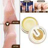 Maxbell Cracking Resistance Cream Moisturizing dry Cracking Feet Hands