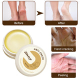 Maxbell Cracking Resistance Cream Moisturizing dry Cracking Feet Hands
