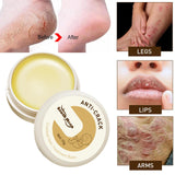 Maxbell Cracking Resistance Cream Moisturizing dry Cracking Feet Hands