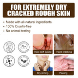 Maxbell Cracking Resistance Cream Moisturizing dry Cracking Feet Hands