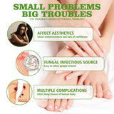 Maxbell Repairing Fungal Nail Treatment 30ml Safe for Broken Cracked and Split Nails