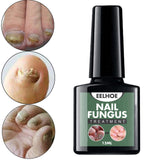 Maxbell Nail Fungal Treatment 15ml Nails Manicure for Nail Cracking Discoloration