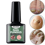 Maxbell Nail Fungal Treatment 15ml Nails Manicure for Nail Cracking Discoloration
