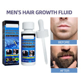 Maxbell Men Hair and Beard Growth Fluid Stronger Thicker Longer Hair Full Thickening