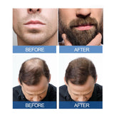 Maxbell Men Hair and Beard Growth Fluid Stronger Thicker Longer Hair Full Thickening